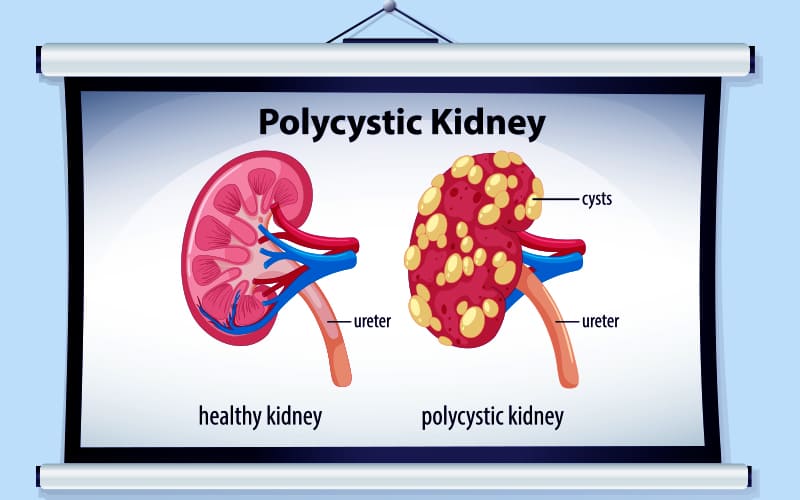 best kidney specialist in Kolkata