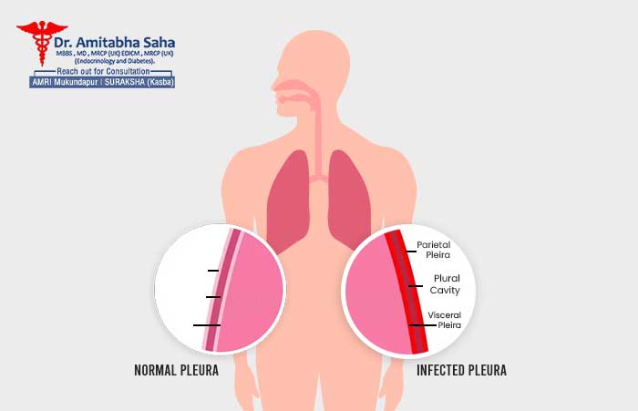 chest pain treatment in Kolkata