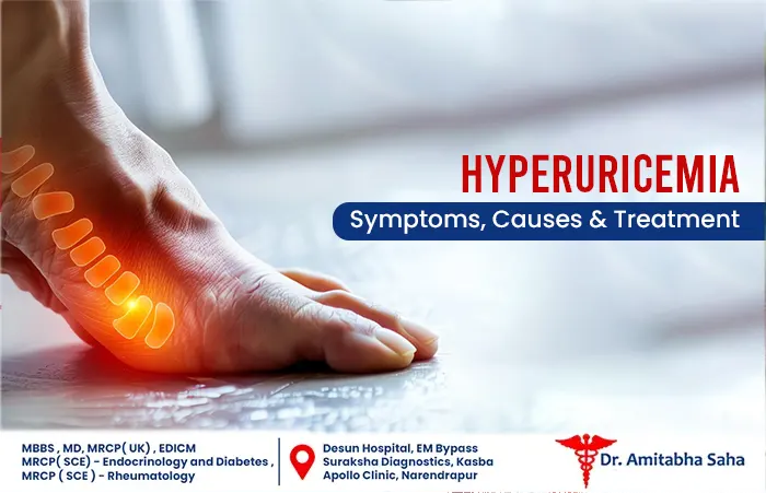 hyperuricemia treatment