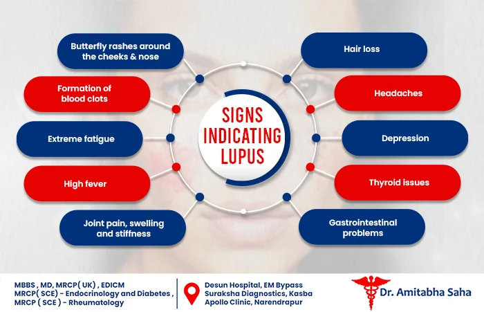 Signs Indicating Lupus