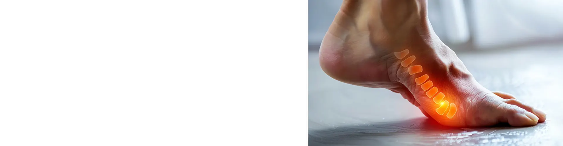 hyperuricemia treatment