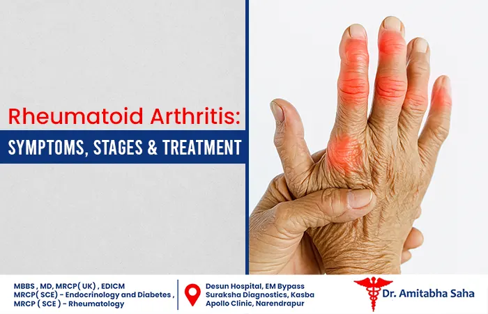 rheumatoid arthritis treatment in Kolkata
