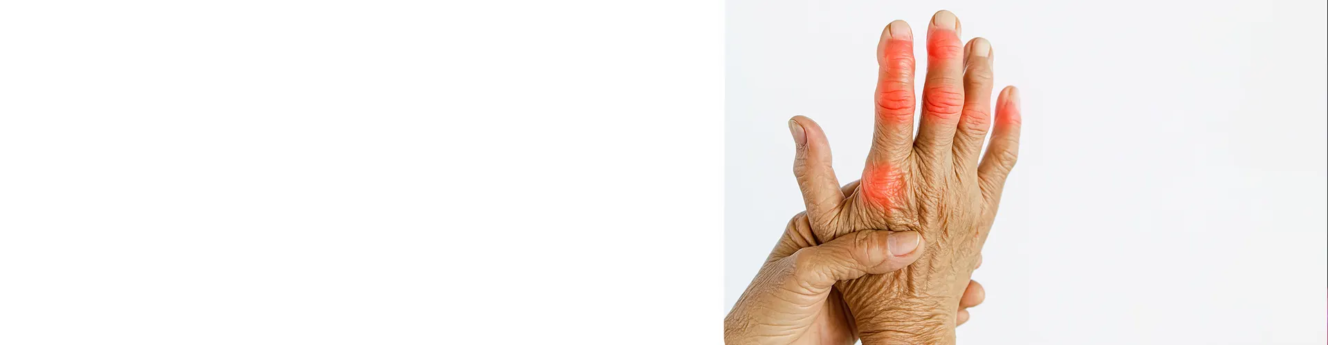 rheumatoid arthritis treatment in Kolkata