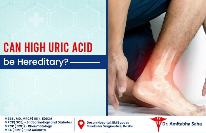 high uric treatment