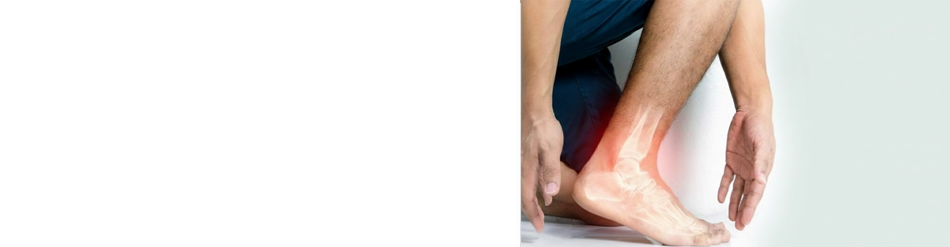 high uric treatment
