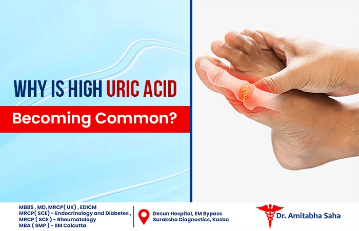 High Uric Acid Treatment